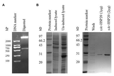 Ac-HSP20 Is Associated With the Infectivity and Encystation of <mark class="highlighted">Acanthamoeba castellanii</mark>